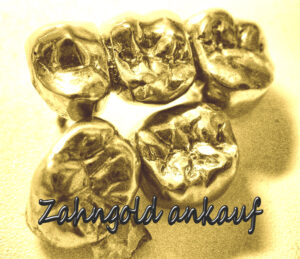 Zahngold verkaufen